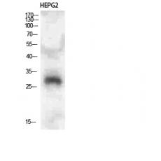 Anti-CLECSF6 antibody