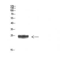 Anti-Imp3 antibody