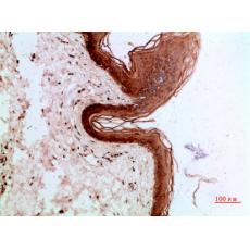 Anti-Cytokeratin 14/17 antibody