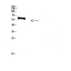 Anti-FBXO7 antibody