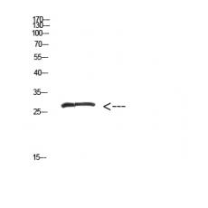 Anti-MYOZ2 antibody