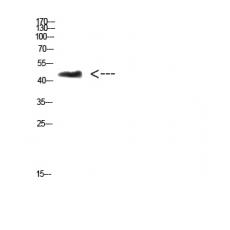 Anti-CHID1 antibody