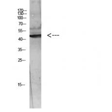 Anti-WISP-3 antibody
