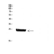 Anti-CSH1 antibody