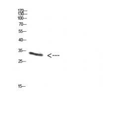 Anti-PENK antibody