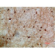 Anti-NFAT5 antibody