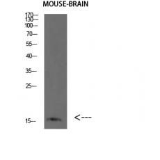 Anti-BLBP antibody