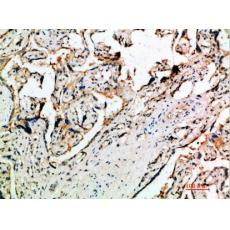 Anti-DDT antibody