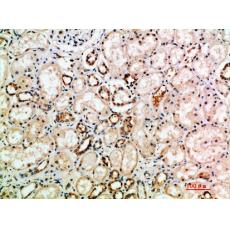 Anti-NT-3 antibody