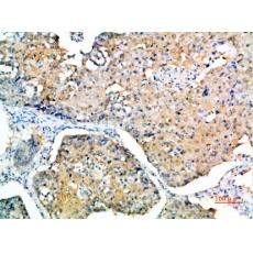 Anti-SOCS-3 antibody