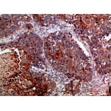 Anti-MLL antibody