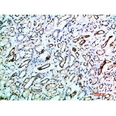 Anti-CD231 antibody