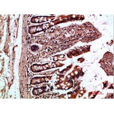 Anti-OSM antibody