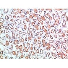 Anti-CD1B antibody