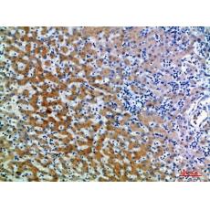 Anti-CD109 antibody