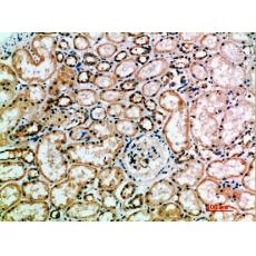 Anti-CD158f1/2 antibody