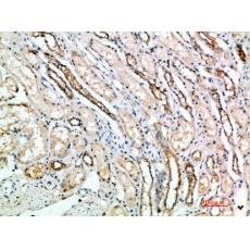 Anti-CD297 antibody