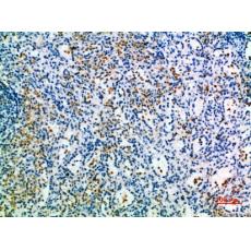 Anti-CD327 antibody