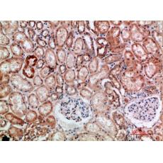 Anti-BTN3A1/2/3 antibody