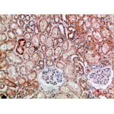 Anti-BTN3A1/2/3 antibody