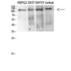 Anti-DAAM1 antibody