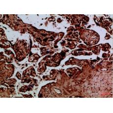 Anti-NAIP antibody