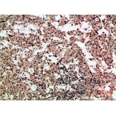 Anti-PF-4 antibody