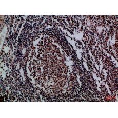 Anti-IL-17D antibody