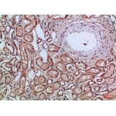 Anti-CD66a/b/c antibody
