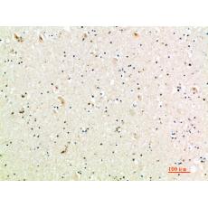 Anti-MIG antibody