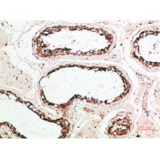 Anti-PACAP antibody