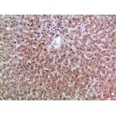 Anti-Epiregulin antibody