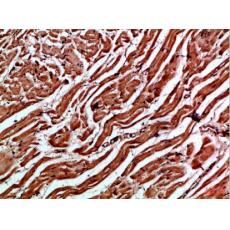 Anti-Cytoglobin antibody