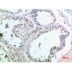 Anti-PMCH antibody