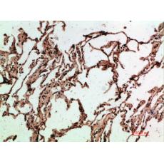 Anti-ADI1 antibody