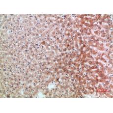 Anti-ST2 antibody