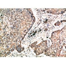 Anti-Napsin A antibody