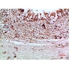 Anti-Thyroglobulin antibody