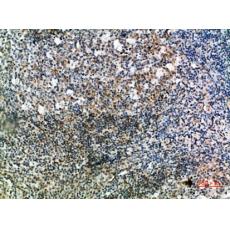 Anti-IgD antibody