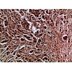 Anti-HDGF antibody