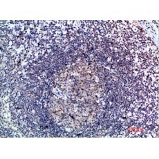 Anti-6CKine antibody