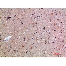 Anti-PBP antibody