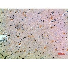 Anti-CCL14 antibody