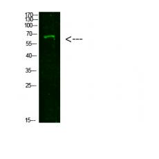Anti-NUT antibody
