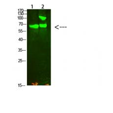 Anti-GCK/GLK antibody