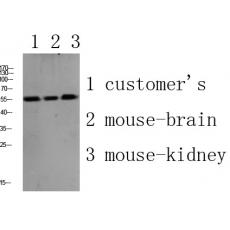 Anti-PLD4 antibody
