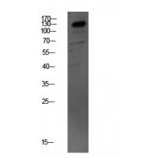 Anti-MYBPC3 antibody