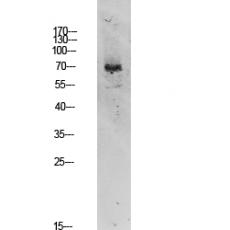 Anti-TIF-IA antibody