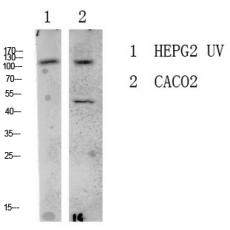 Anti-LATS1/2 antibody