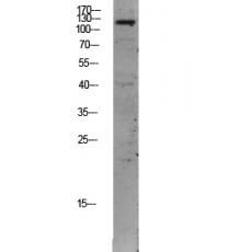 Anti-TIE2 antibody